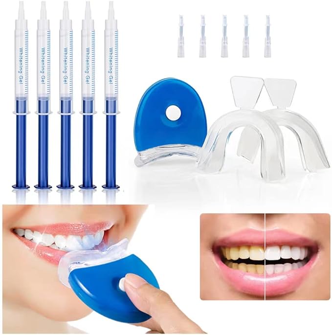 Teeth Whitening Kit with LED Light – Professional Home Whitening System