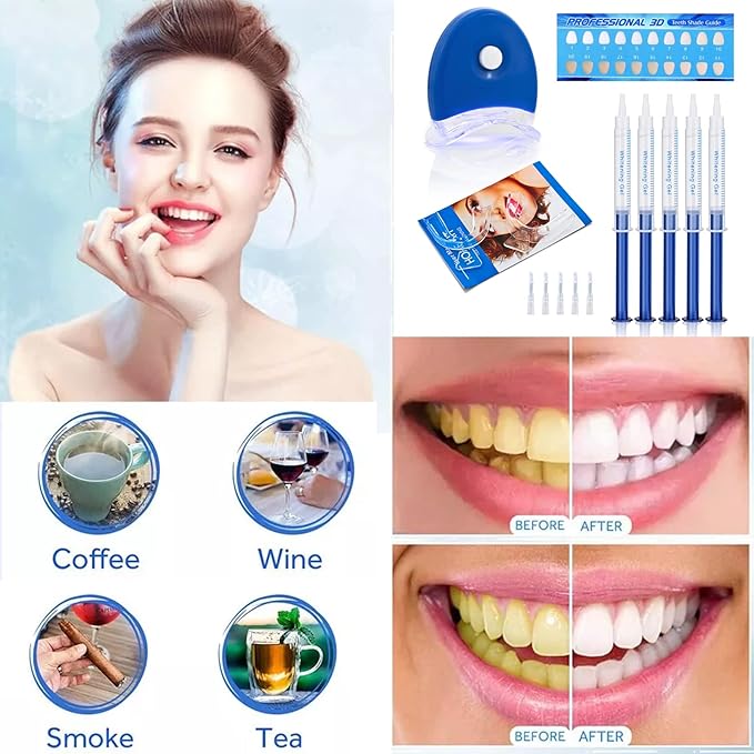 Teeth Whitening Kit with LED Light – Professional Home Whitening System