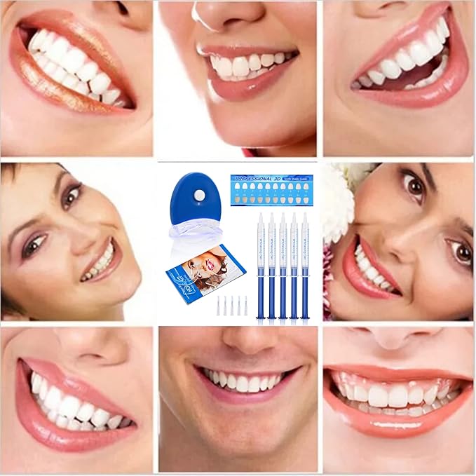 Teeth Whitening Kit with LED Light – Professional Home Whitening System